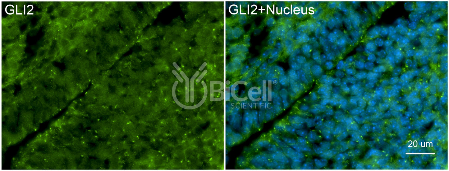 GLI2 Antibody - Western Blot Validated