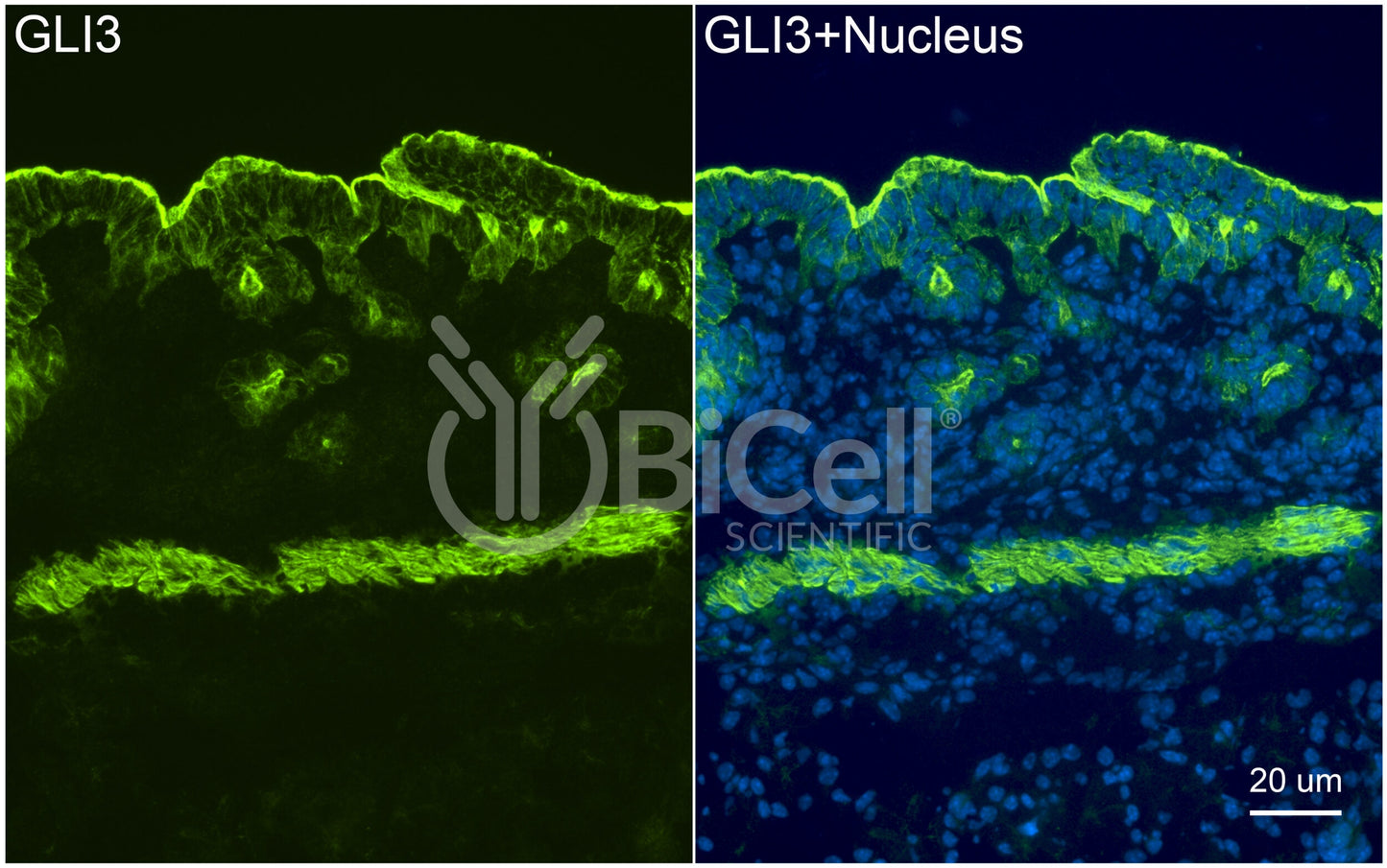 GLI3 Antibody - Western Blot Validated