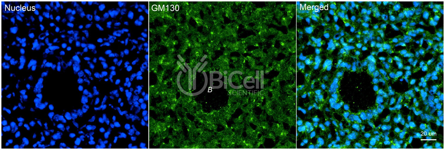 GOLGA2 (GM130) Antibody - Western Blot Validated