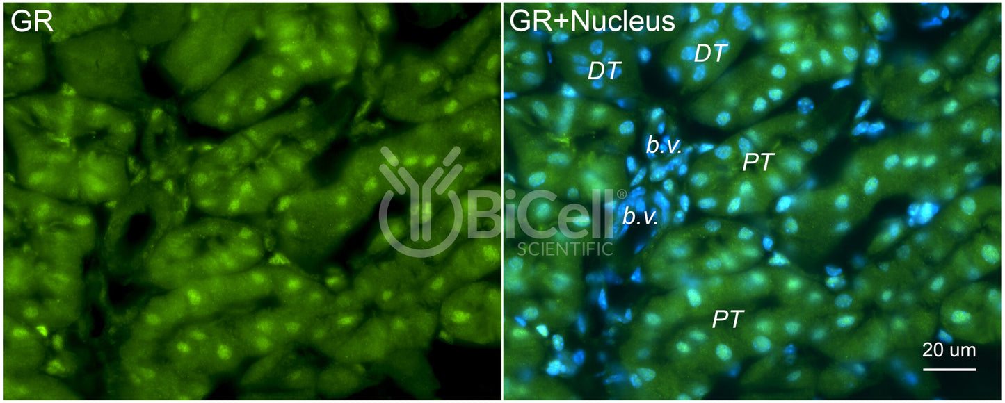 GR (NR3C1) Antibody - FFPE Validated