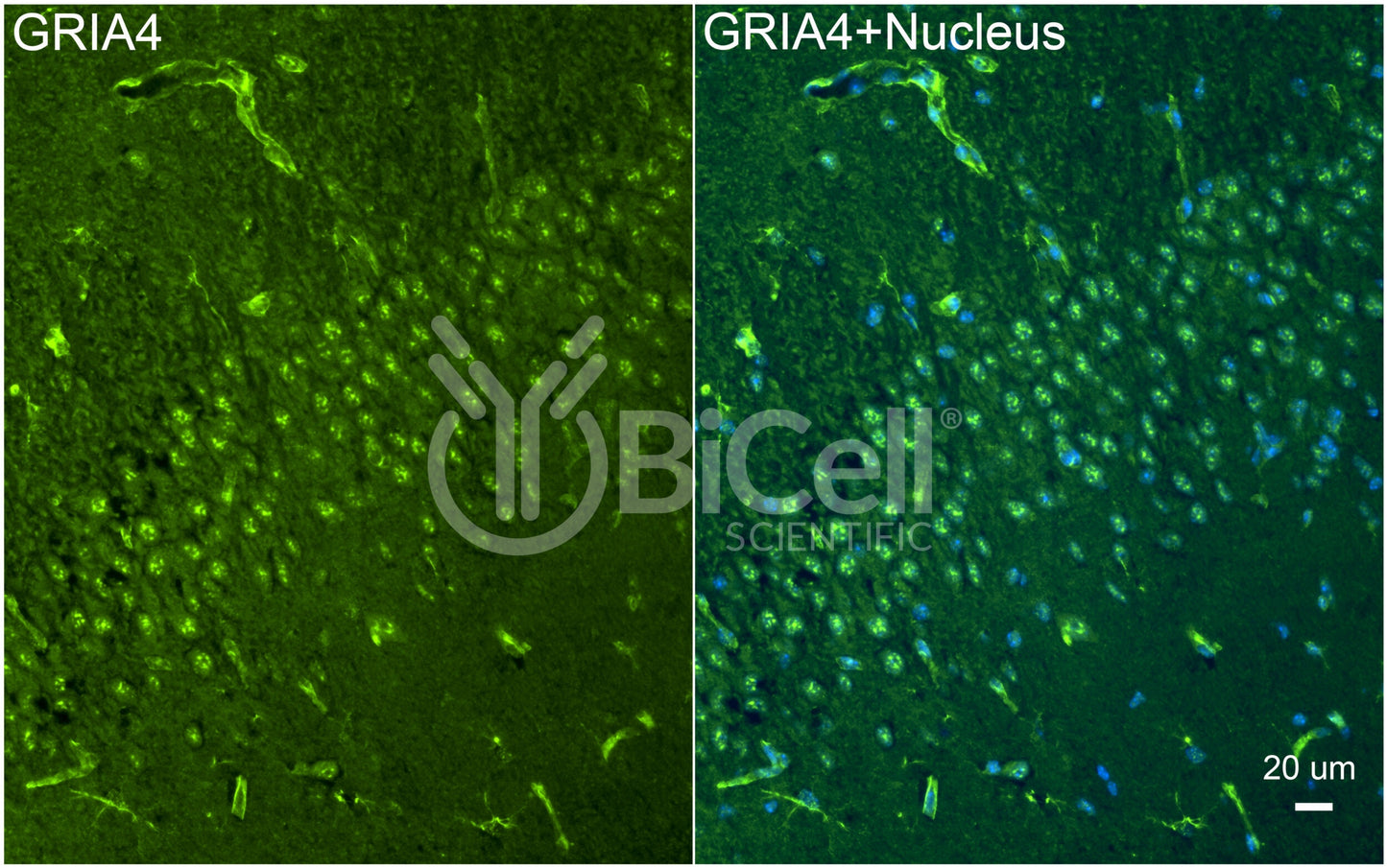 GRIA4 (GluR4 or GluA4) Antibody