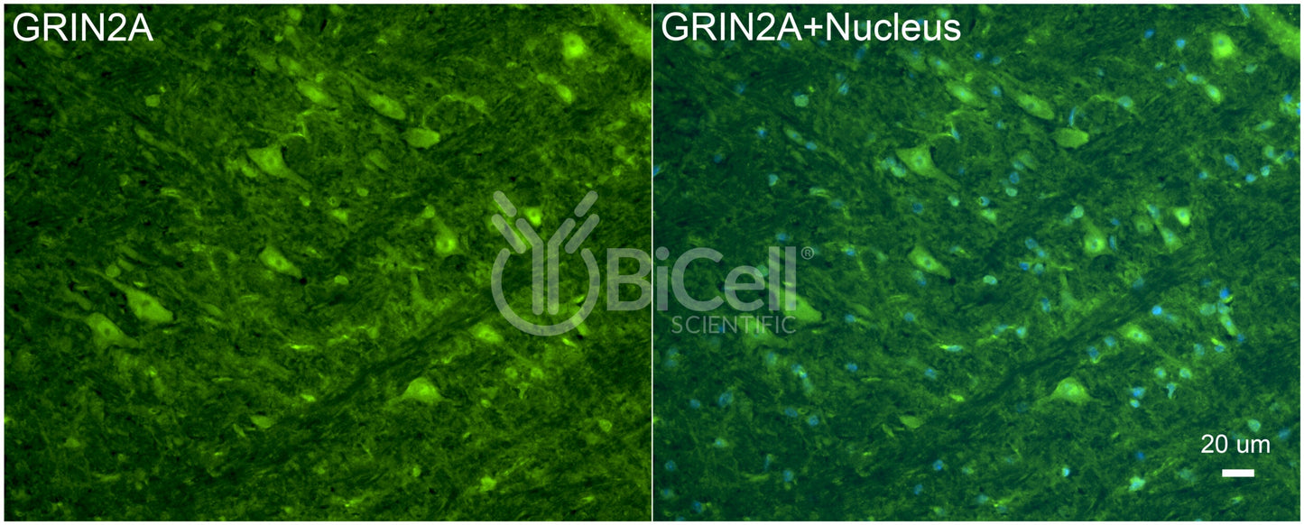 GRIN2A (GluN2A) Antibody - Western Blot Validated