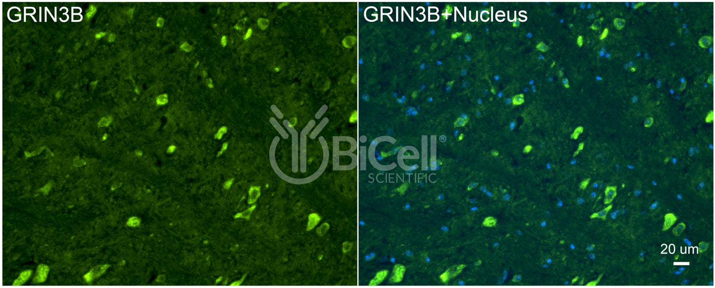 GRIN3B (GluN3B) Antibody - Western Blot Validated