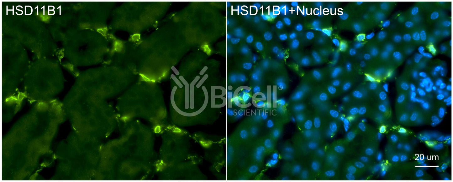 11-beta-HSD1 (HSD11B1) Antibody - Western Blot Validated