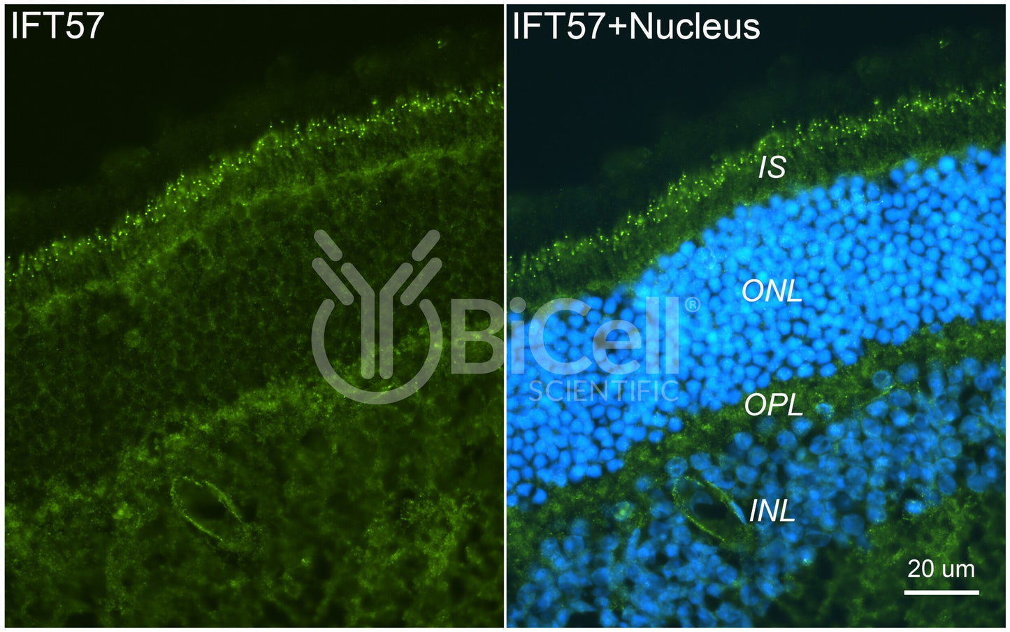 IFT57 Antibody
