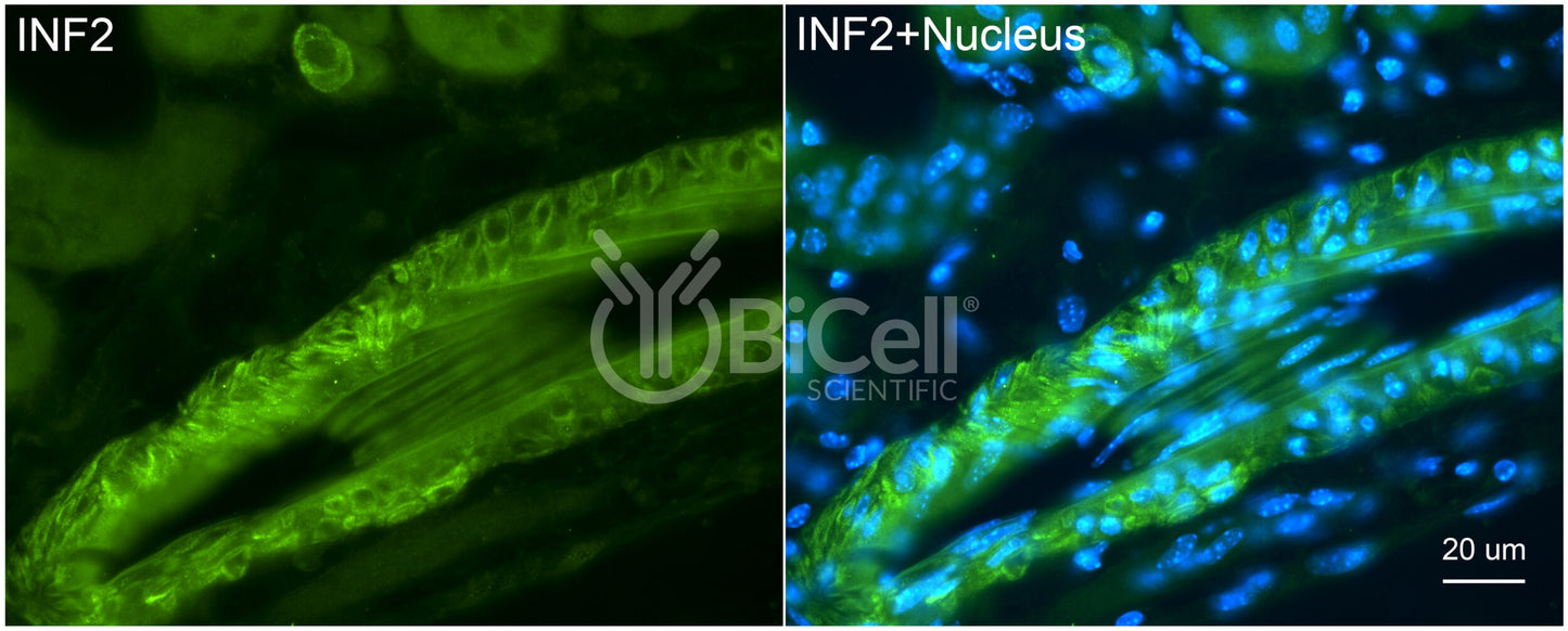INF2 Antibody - Western Blot Validated