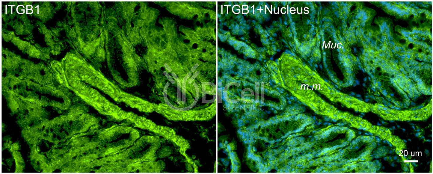 Integrin beta-1 (ITGB1 or CD29) Antibody - Western Blot Validated