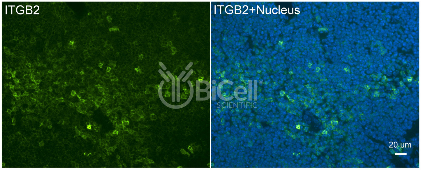 Integrin beta-2 (ITGB2 or CD18) Antibody