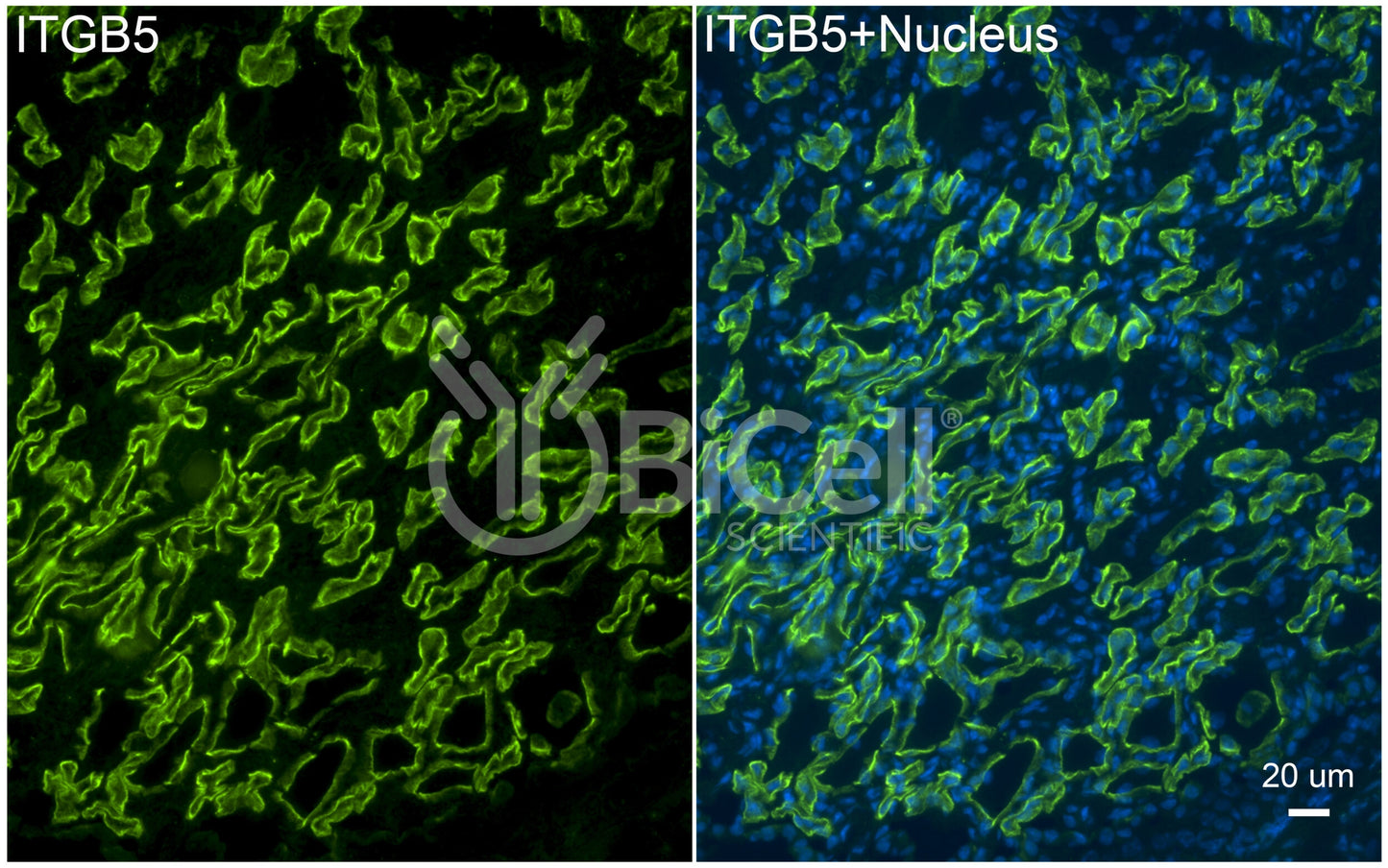 Integrin beta-5 (ITGB5) Antibody - Western Blot Validated