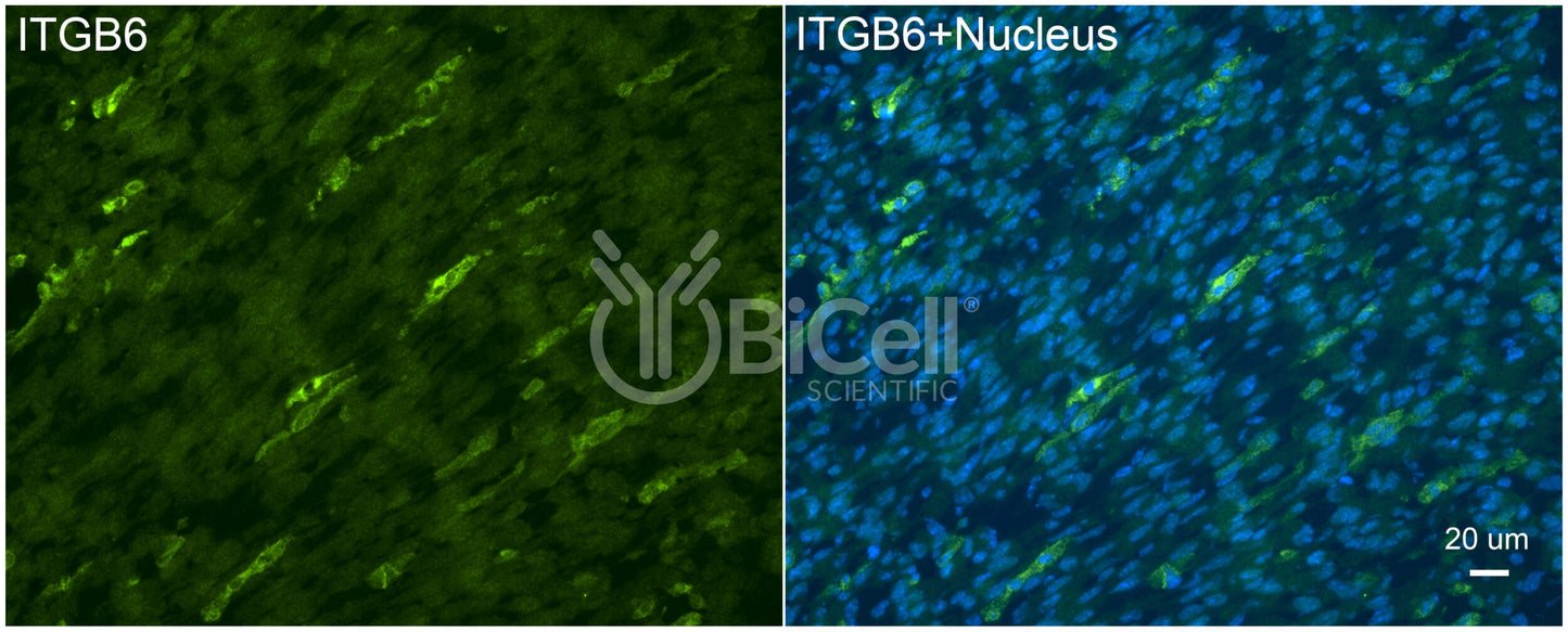 Integrin beta-6 (ITGB6) Antibody