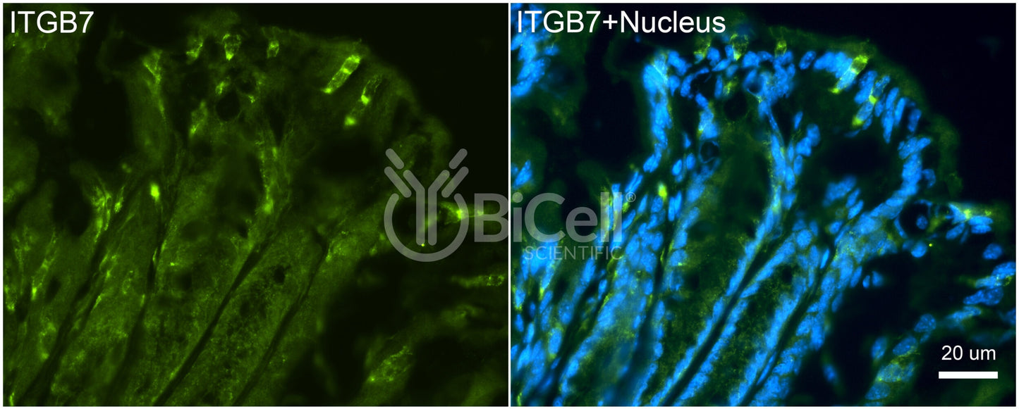 Integrin beta-7 (ITGB7) Antibody - Western Blot Validated