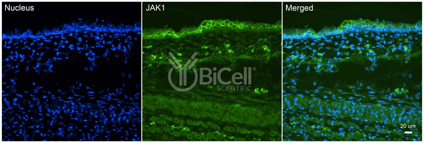 JAK1 (JTK3) Antibody - FFPE Validated