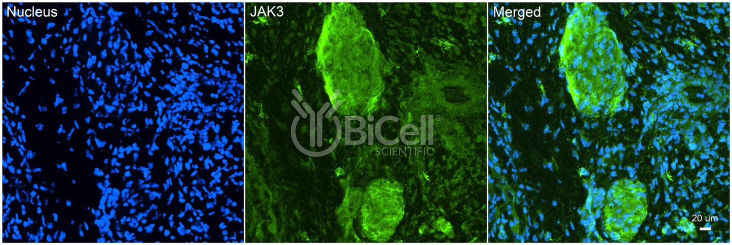 JAK3 (JAKL) Antibody - FFPE Validated
