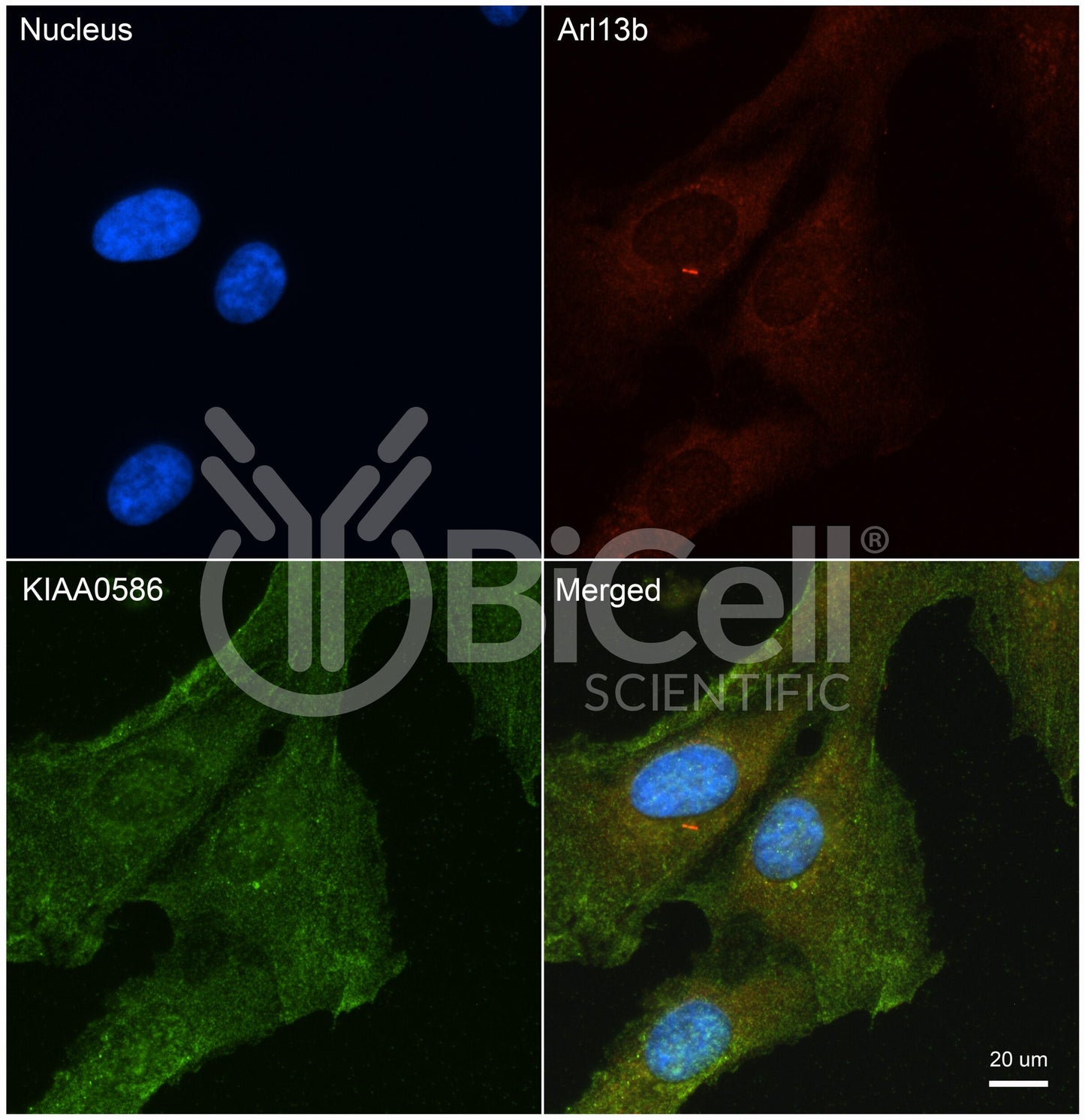 KIAA0586 (TALPID3) Antibody - FFPE Validated