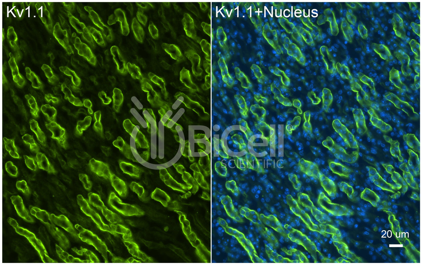 KCNA1 (Kv1.1) Antibody - FFPE Validated