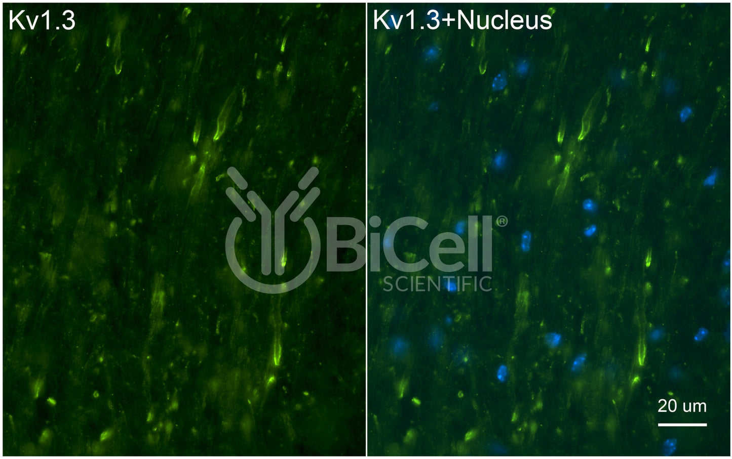 KCNA3 (Kv1.3) Antibody - FFPE Validated