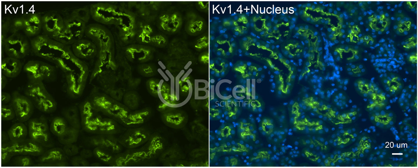KCNA4 (Kv1.4) Antibody - Western Blot Validated