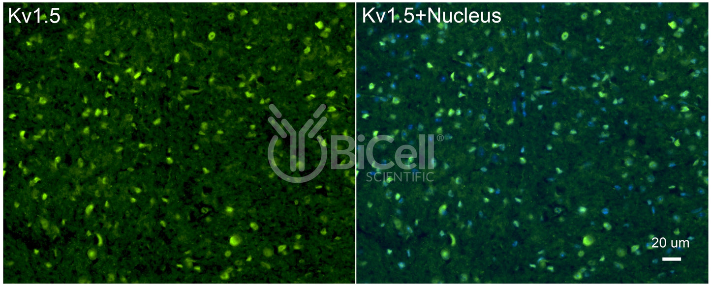 KCNA5 (Kv1.5) Antibody