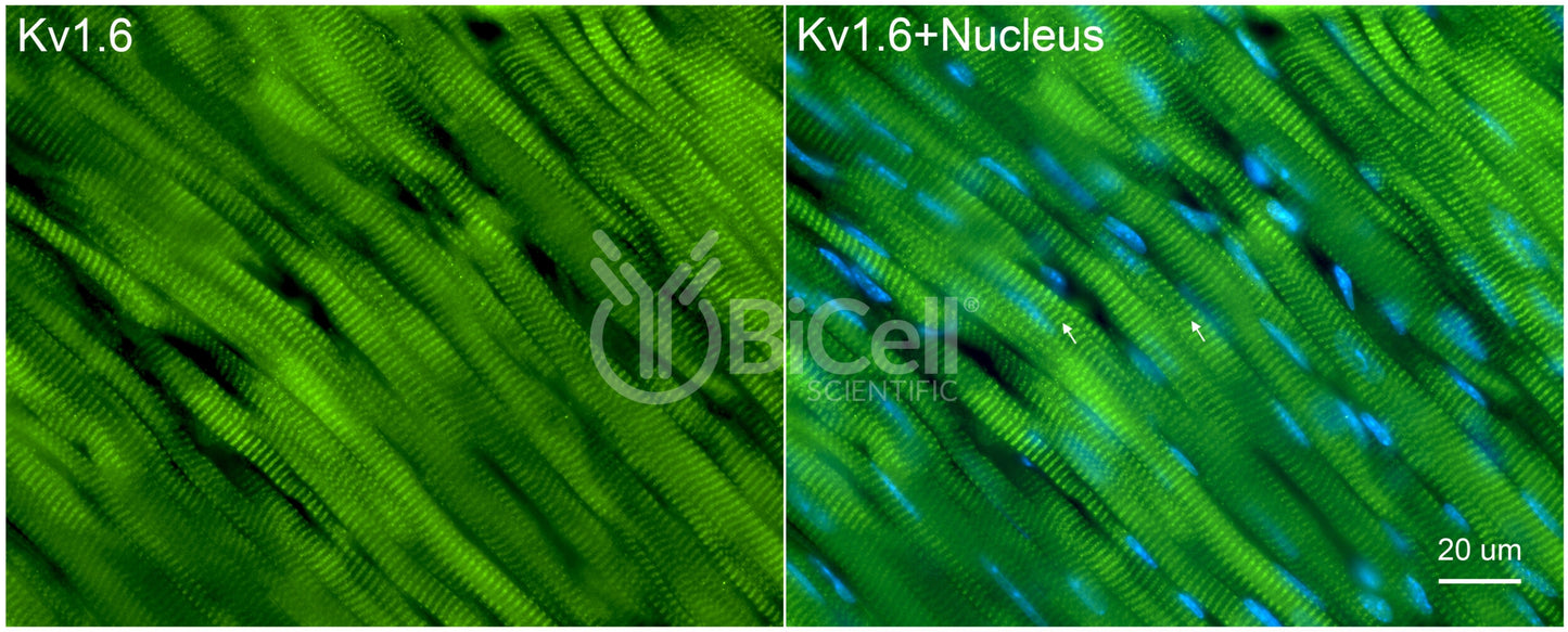 KCNA6 (Kv1.6) Antibody