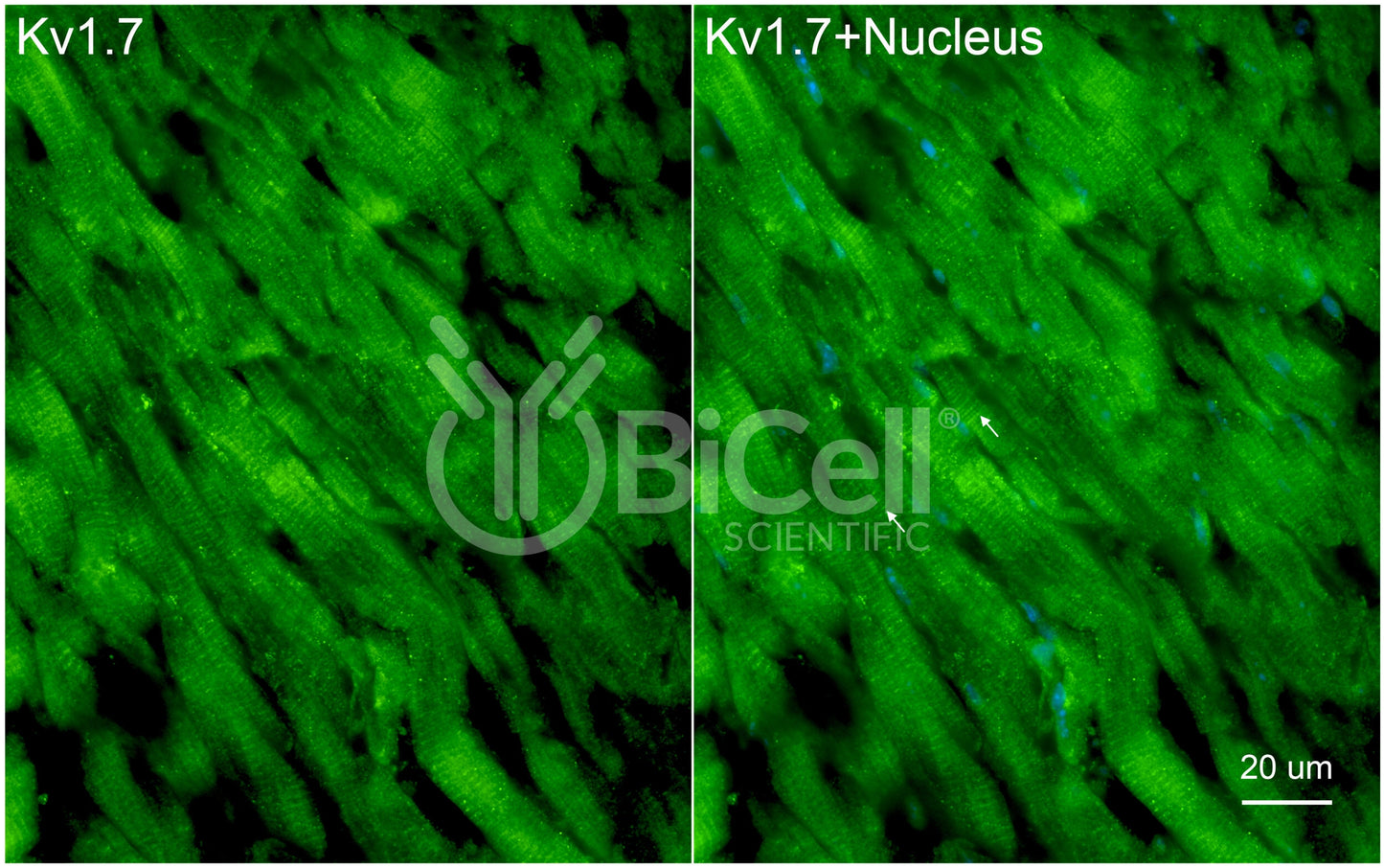KCNA7 (Kv1.7) Antibody - Western Blot Validated