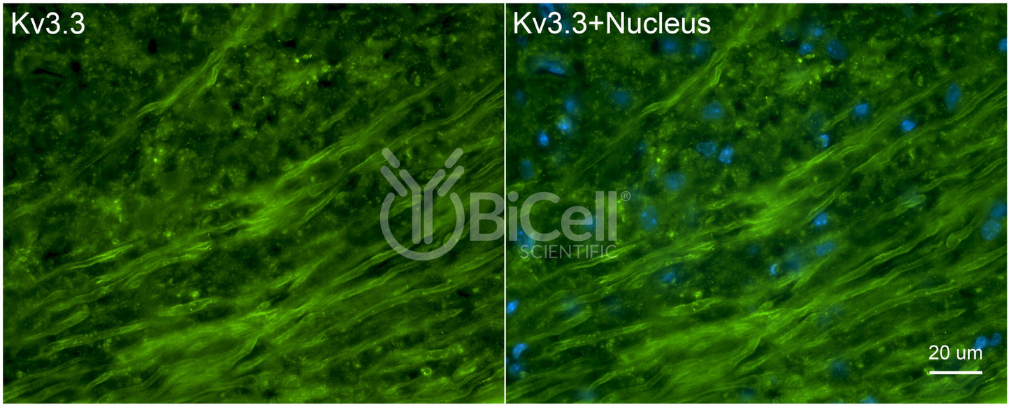 KCNC3 (Kv3.3) Antibody - FFPE Validated