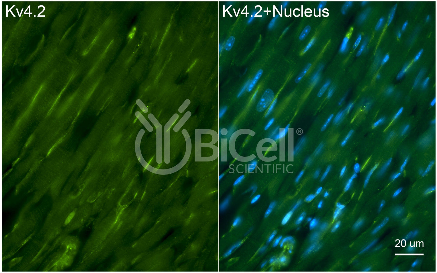 KCND2 (Kv4.2) Antibody