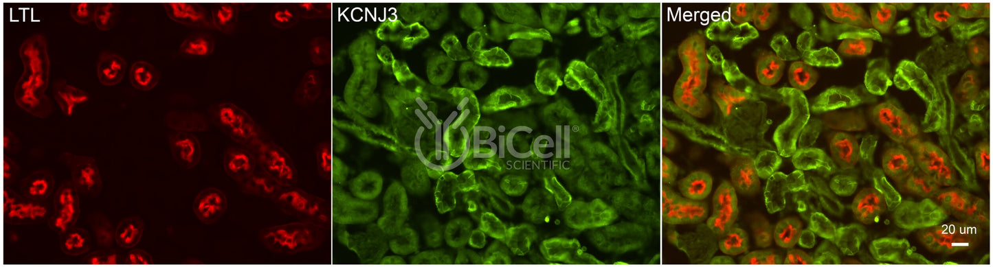 KCNJ3 (Kir3.1 or GIRK1) Antibody - FFPE Validated