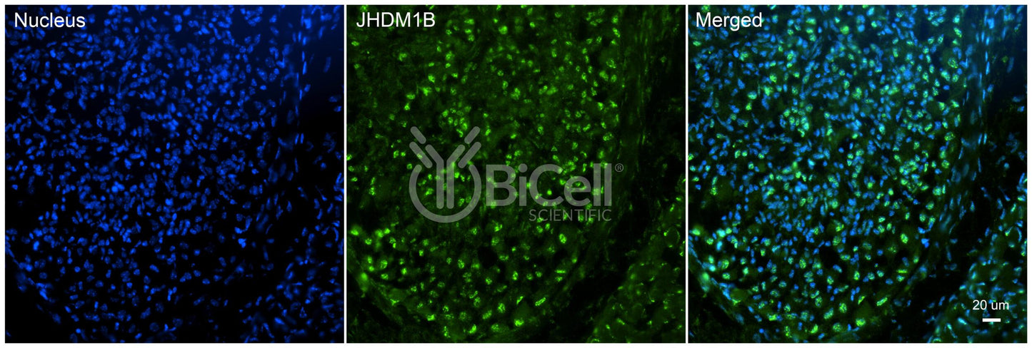 KDM2B (JHDM1B) Antibody