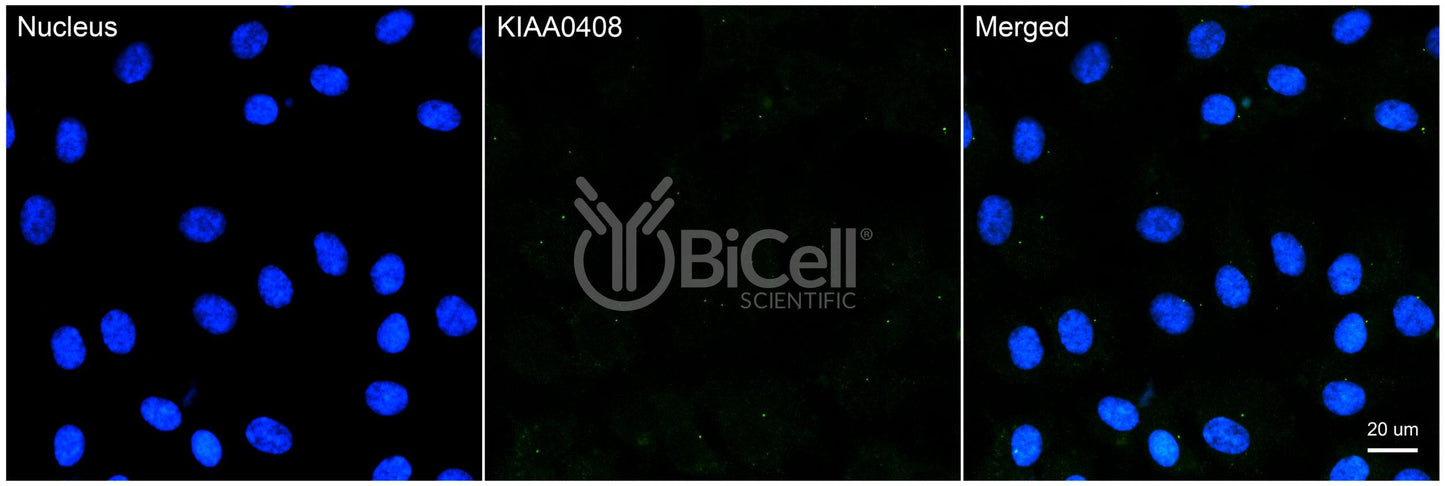 KIAA0408 (N-Terminus) Antibody