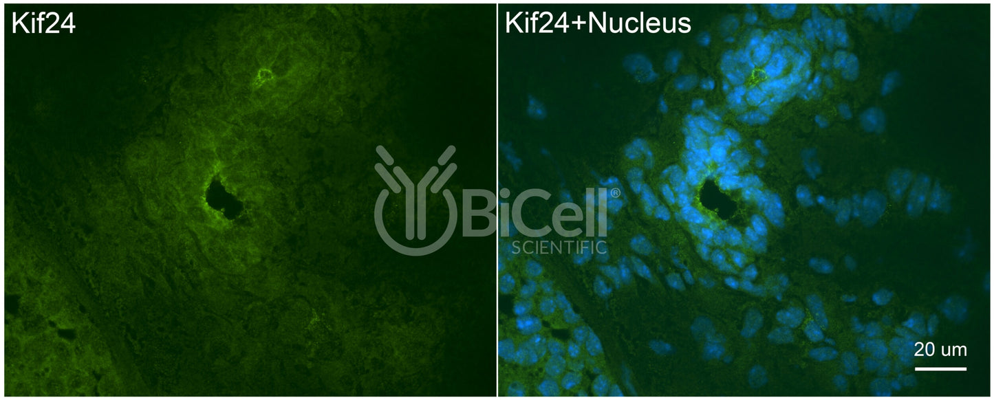 KIF24 Antibody - FFPE Validated