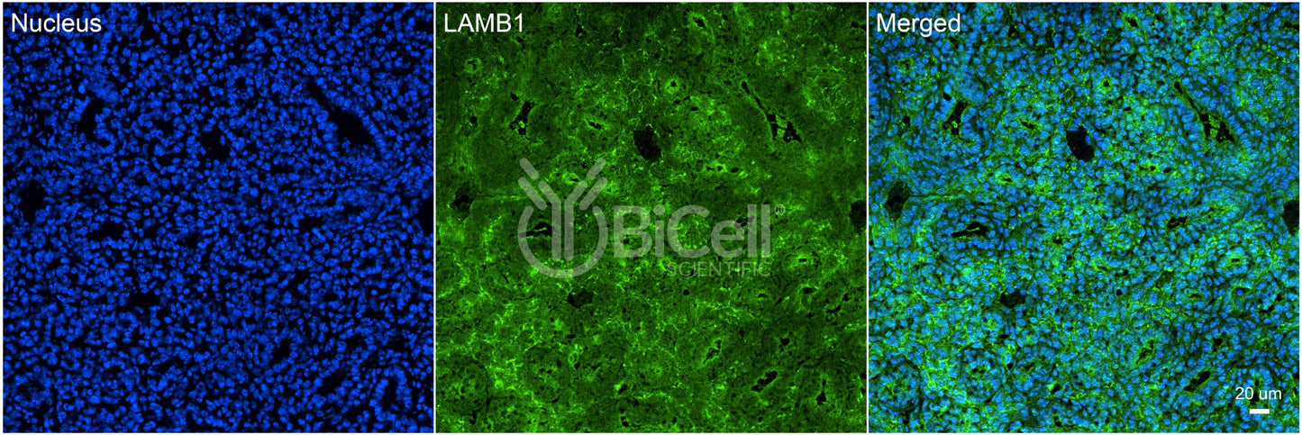 Laminin beta-1 (LAMB1) HiRe Antibody - FFPE Validated