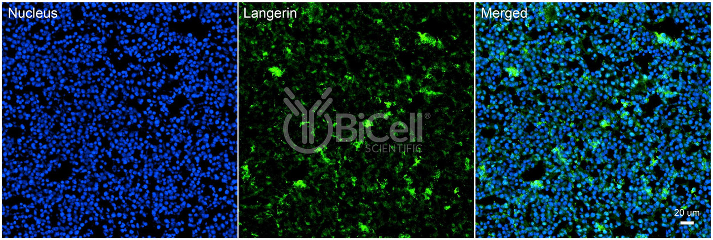 Langerin (CLEC4K or CD207) Antibody - Western Blot Validated