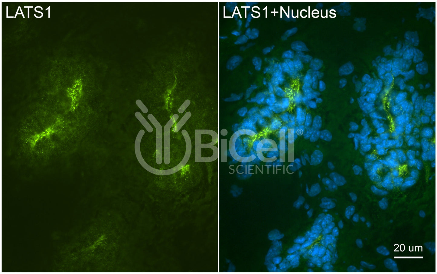 LATS1 (WARTS or wts) Antibody - FFPE Validated