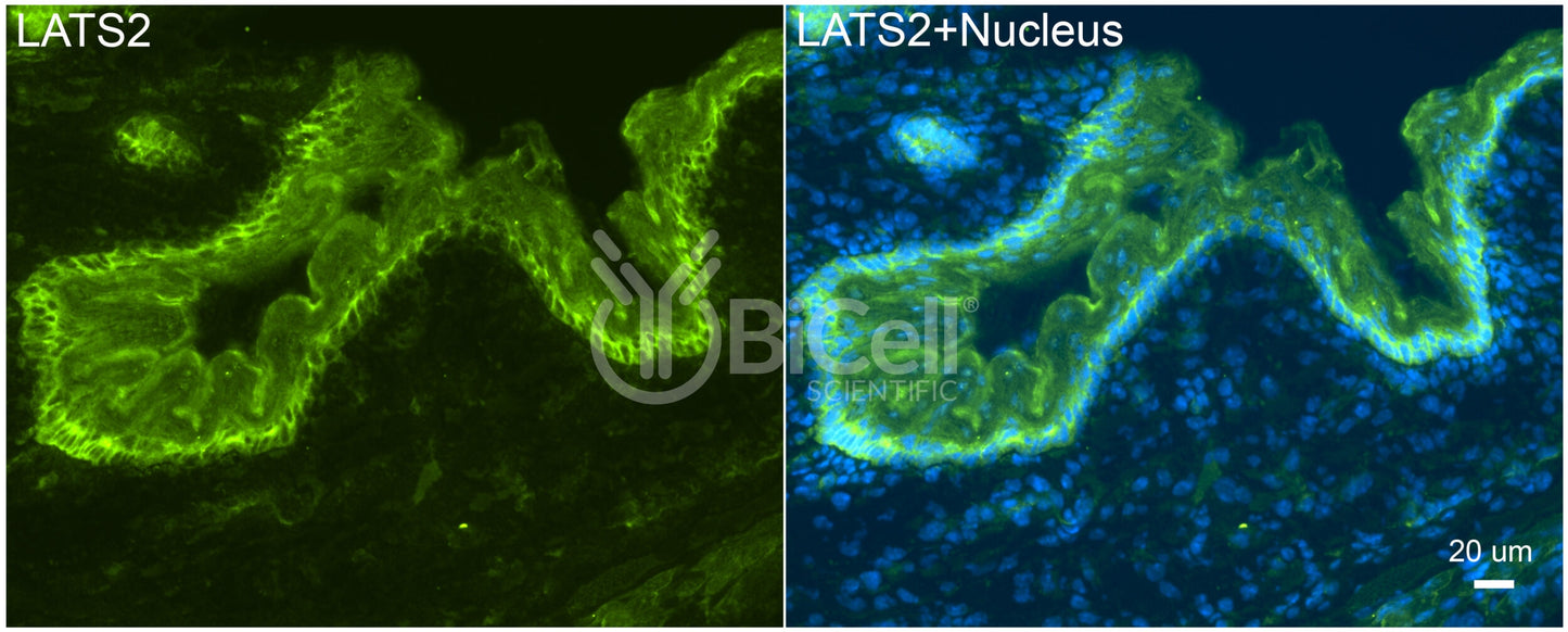 LATS2 (KPM) Antibody - FFPE Validated