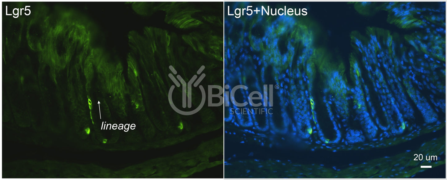 LGR5 (GPR49 or GPR67) Antibody - FFPE Validated