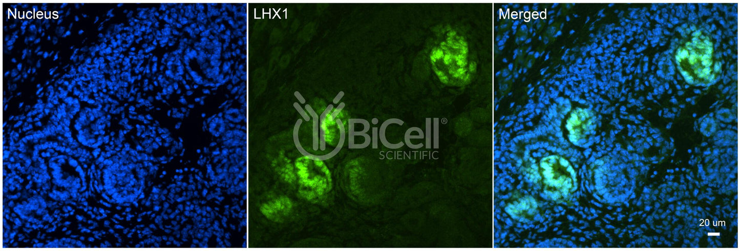 LHX1 (LIM1) Antibody