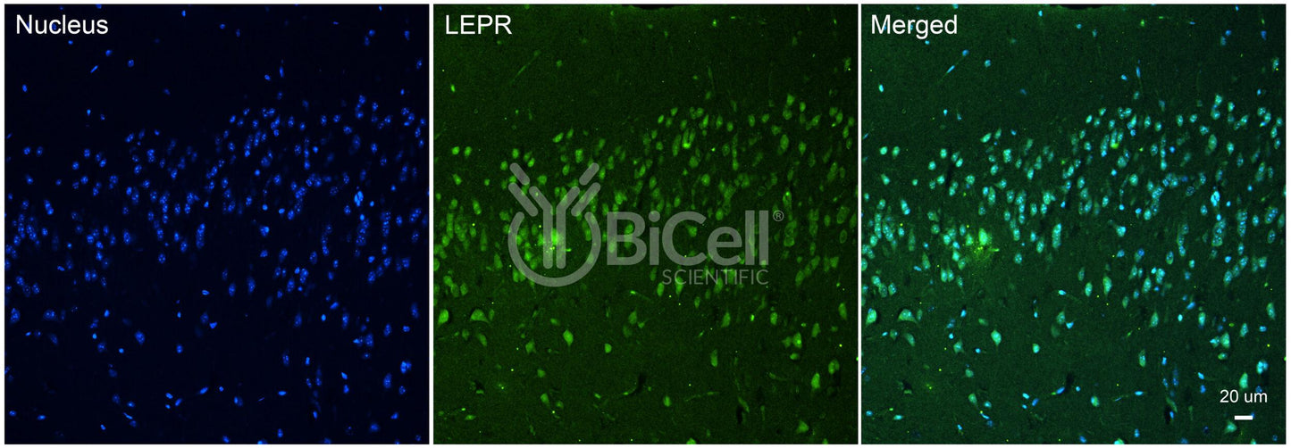 Leptin receptor (LEPR or CD295) Antibody