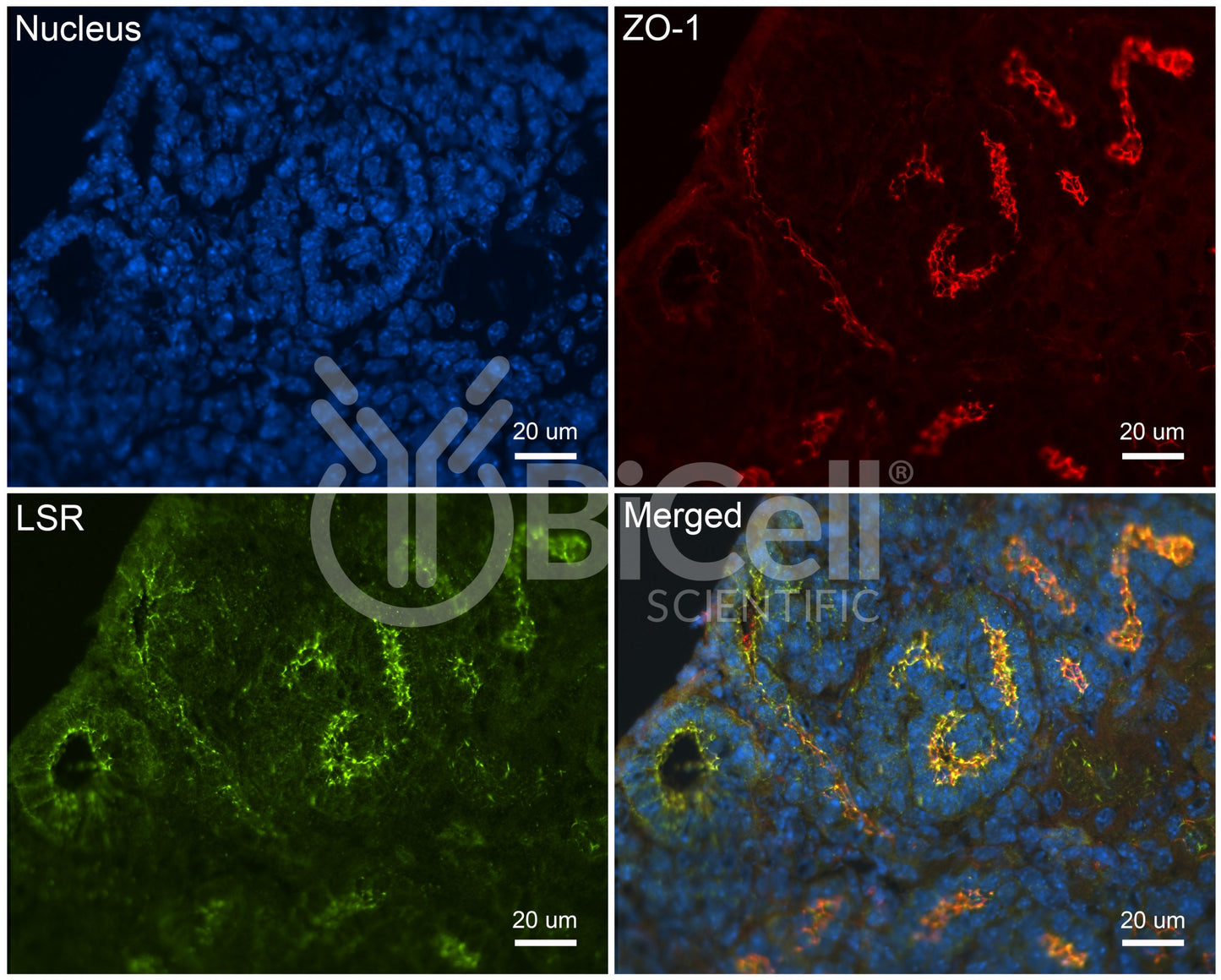 LSR (Angulin-1) Antibody - FFPE Validated