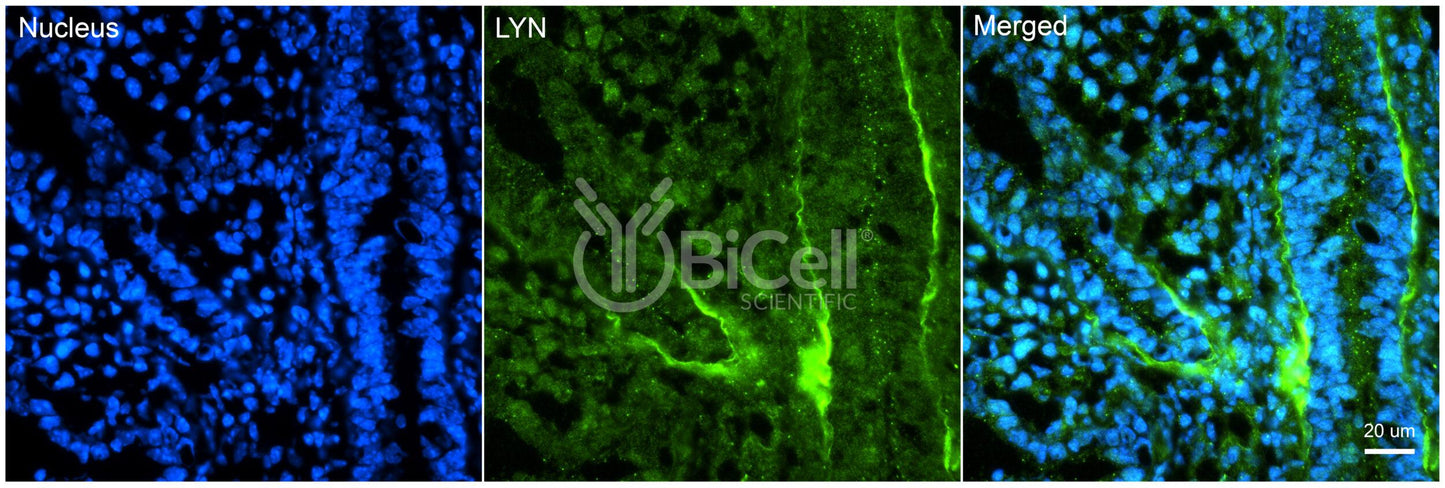 LYN (JTK8) Antibody - FFPE Validated