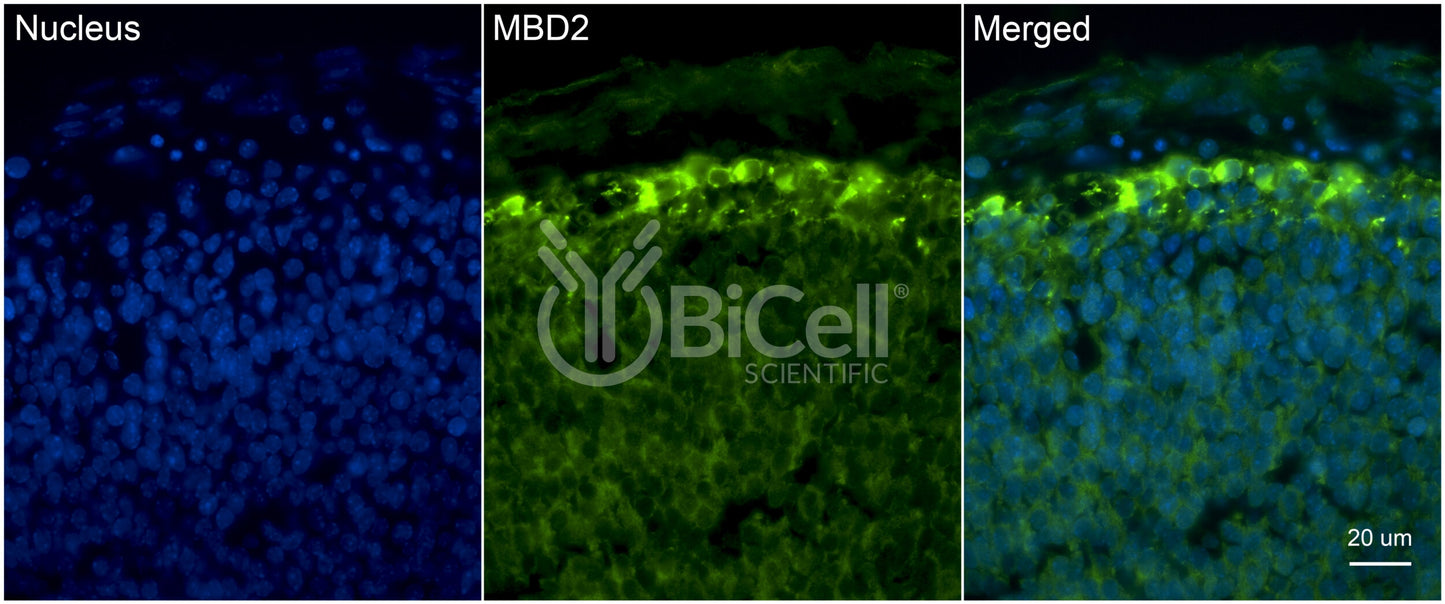 MBD2 (DMTase) Antibody - Western Blot Validated