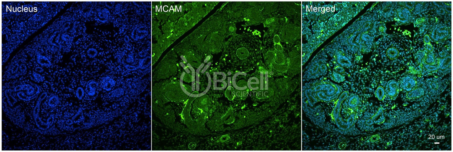 MCAM (CD146 or MUC18) Antibody