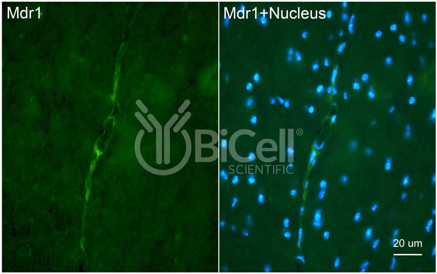 P-glycoprotein (MDR1 or ABCB1 or CD243) Antibody - FFPE Validated