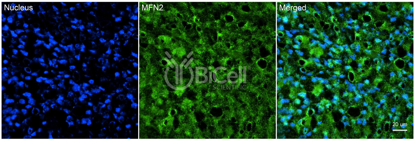 Mitofusin-2 (MFN2) Antibody - FFPE Validated
