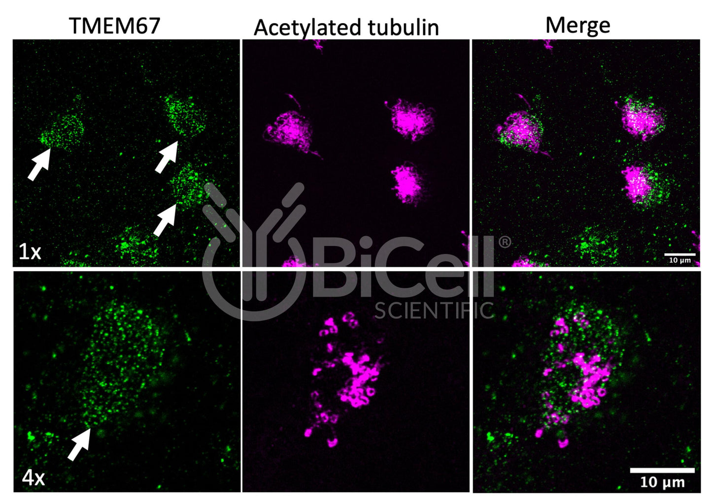 MKS3 (NPHP11 or Meckelin or TMEM67) (Xenopus) Antibody