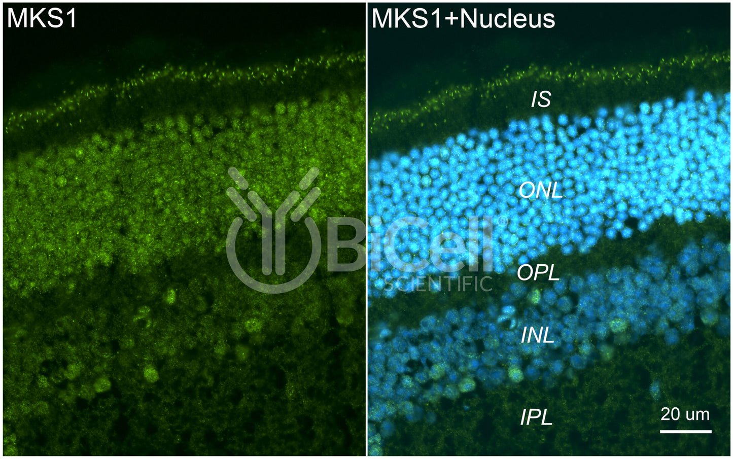 MKS1 (BBS13) Antibody - Western Blot Validated