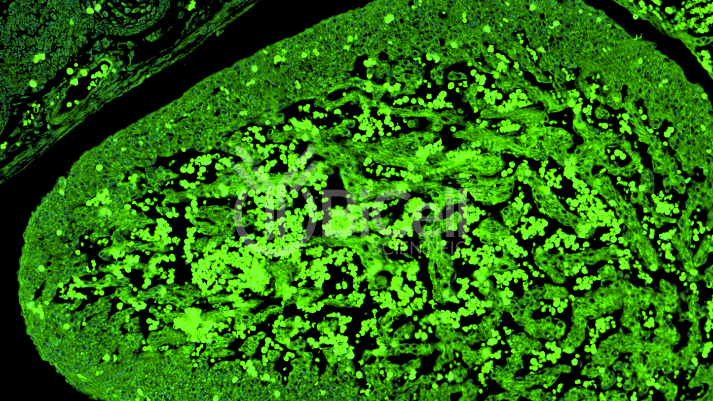 Syncoilin (SYNC) Antibody - FFPE Validated