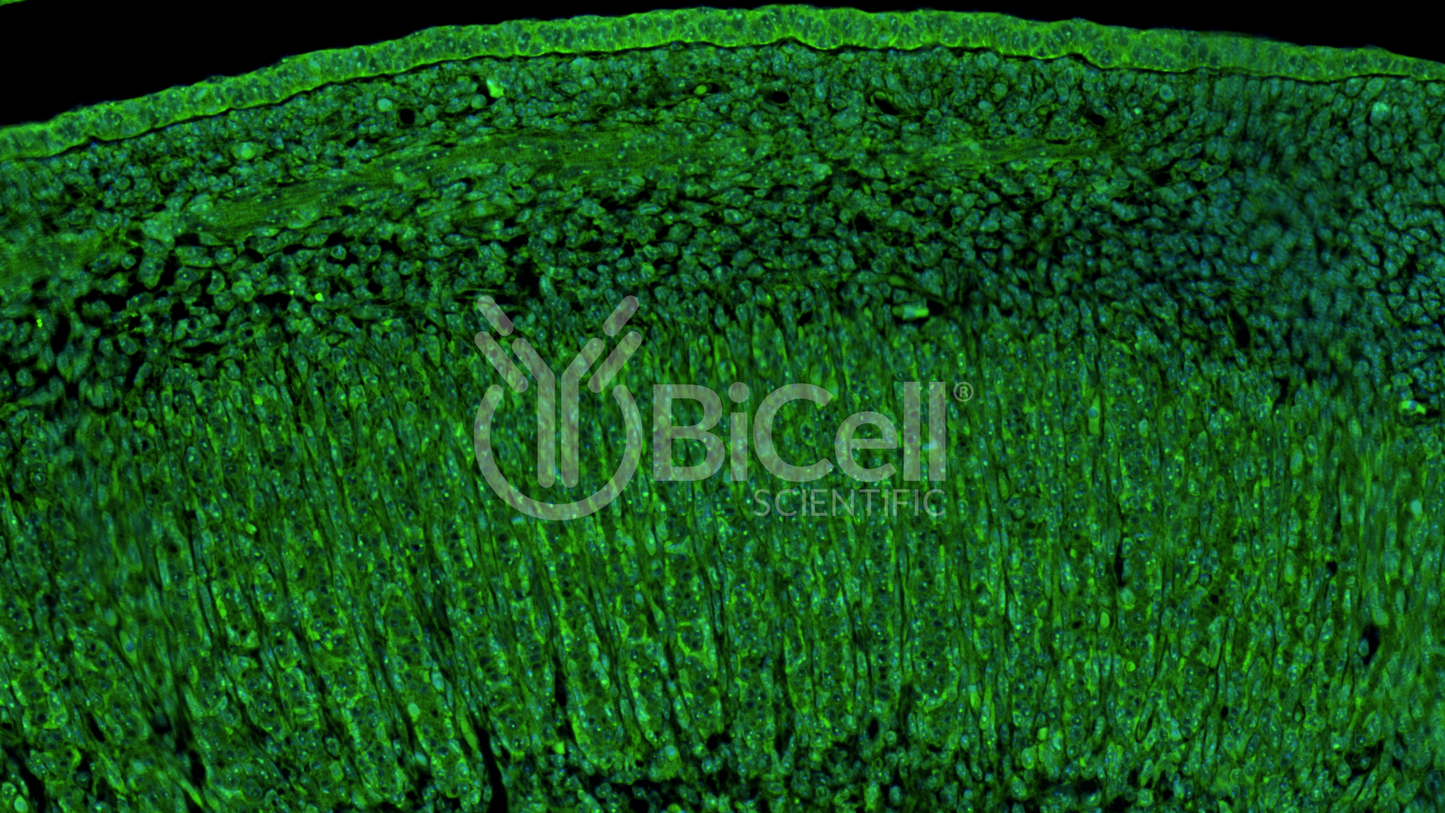 Synemin (SYNM or Desmuslin) Antibody - FFPE Validated