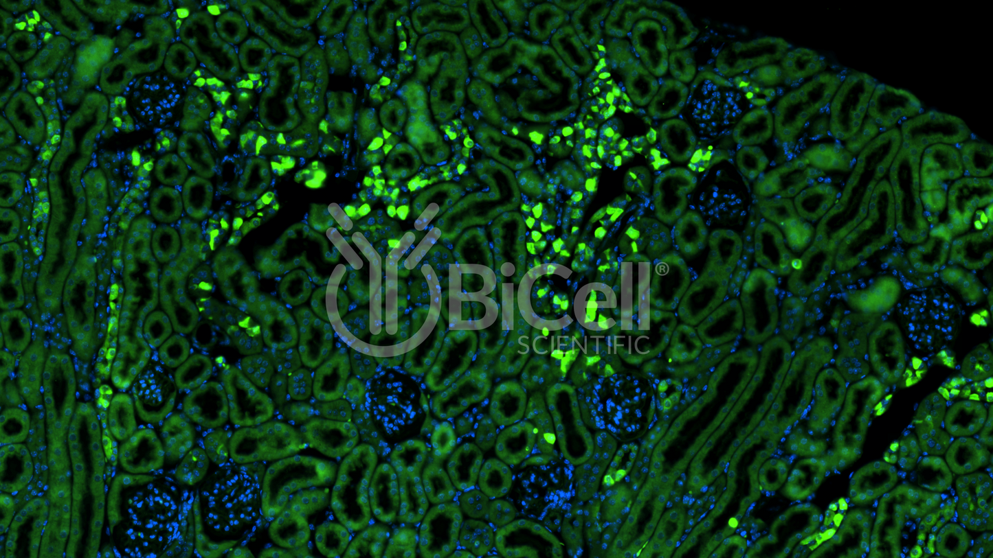 CXCR2 (CD182 or IL8RB) Antibody - FFPE Validated