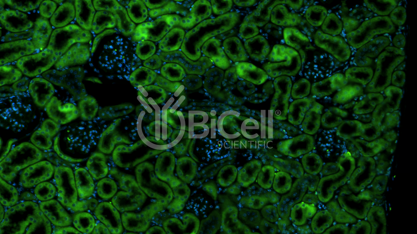 CXCR6 (CD186) Antibody - Western Blot Validated