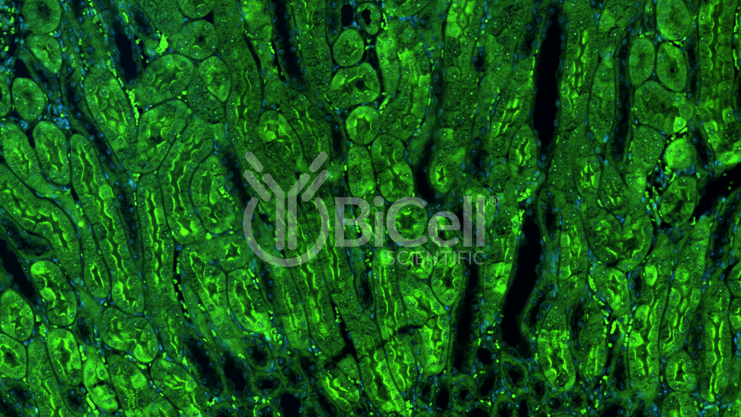 Integrin alpha-D (ITGAD or CD11d) Antibody - Western Blot Validated